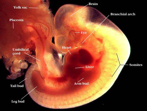 Abortion 1 Month